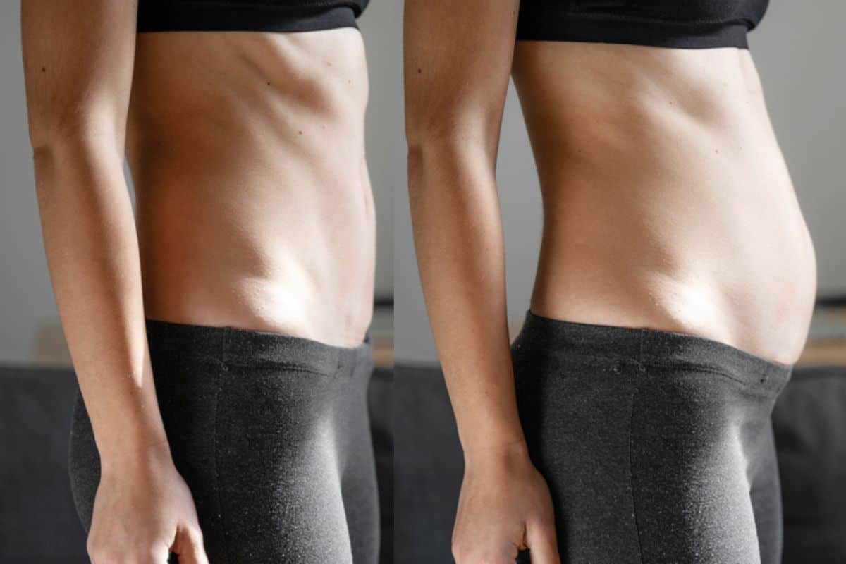 How long does diastasis recti take to improve Taunton?