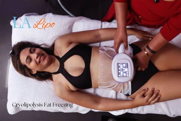 woman getting cryolipolysis Taunton