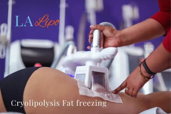 women getting fat freezing Taunton