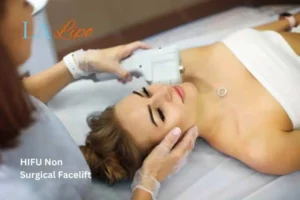 Woman having Hi-Fu to reduce wrinkles Taunton.