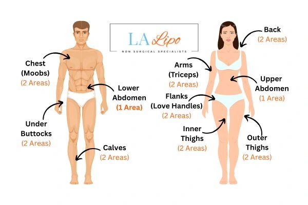LA LIPO Cryolipolysis Areas Taunton