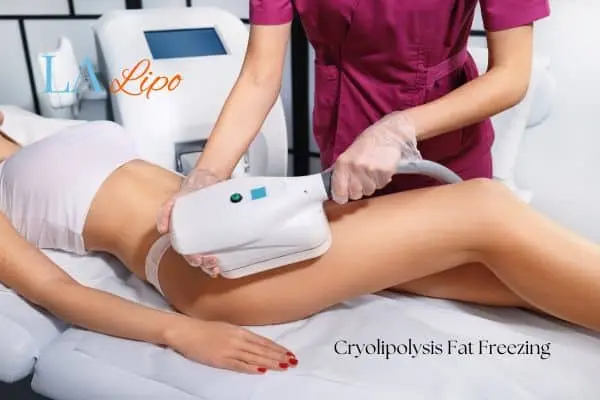 Woman receiving coolsculpting Taunton treatment on her thighs