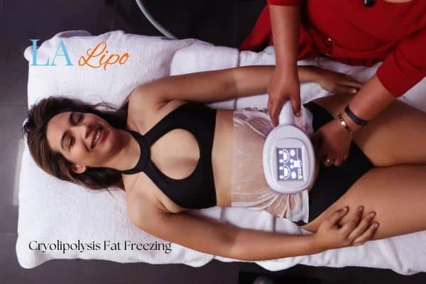 woman getting cryolipolysis Taunton