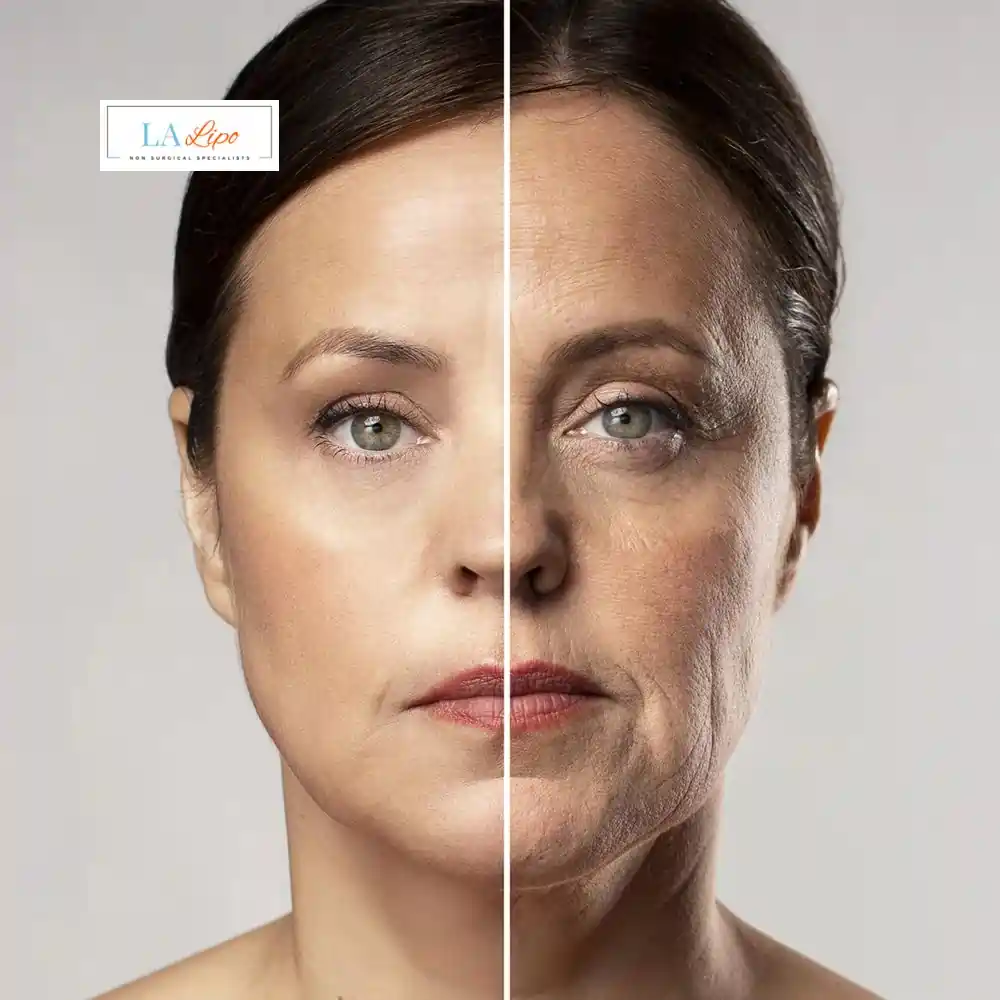 How Can You Tell If Non-Surgical Skin Tightening Is Right for You Taunton?